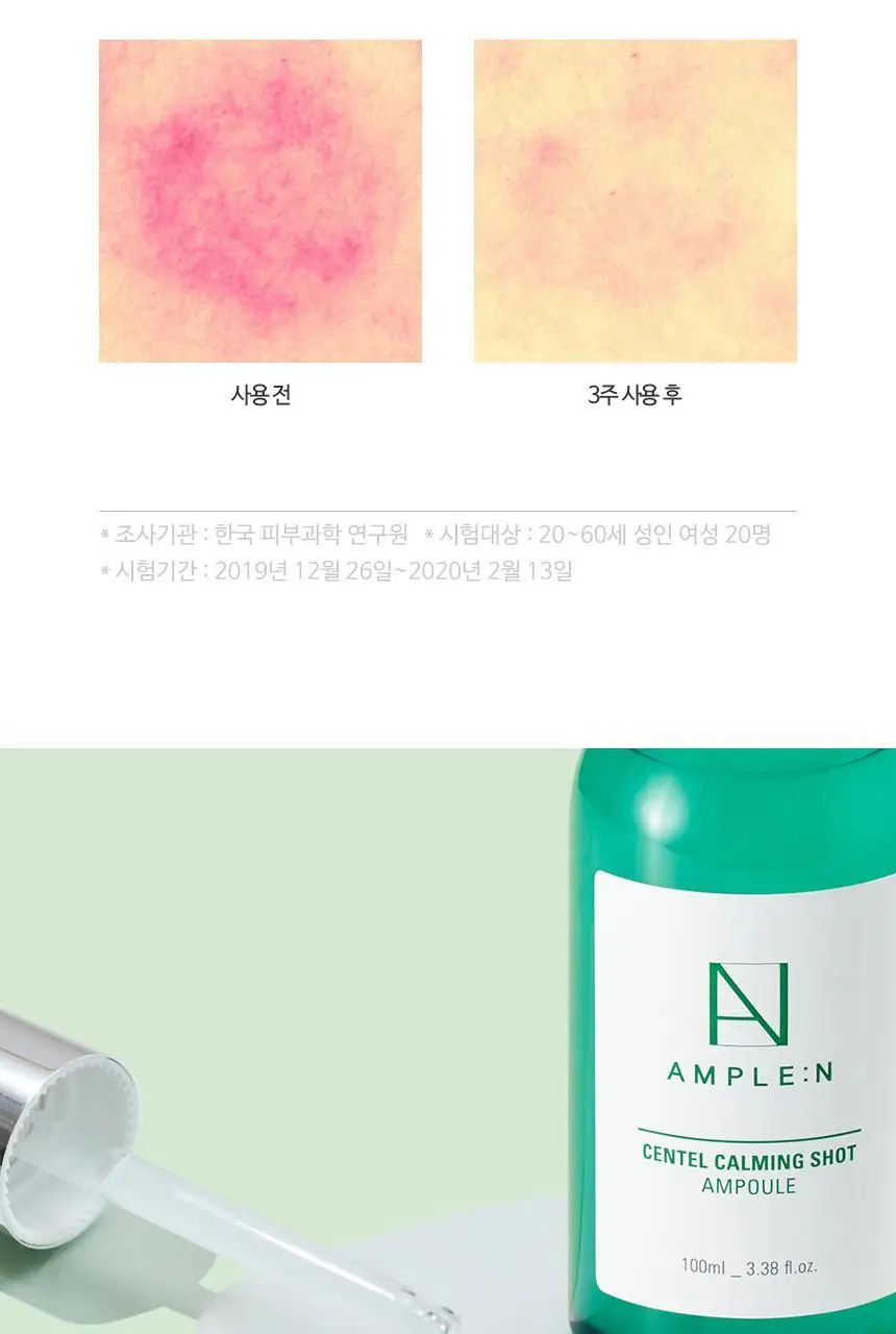 [민감피부진정] 앰플엔 센텔카밍샷 시카진정앰플 100ml 상세페이지 17